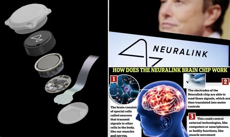 rfid chip in head|Elon Musk's Neuralink Has Implanted Its First Chip in a .